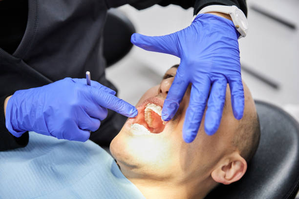 Best Emergency Dentist for Knocked-Out Tooth in Spring, TX